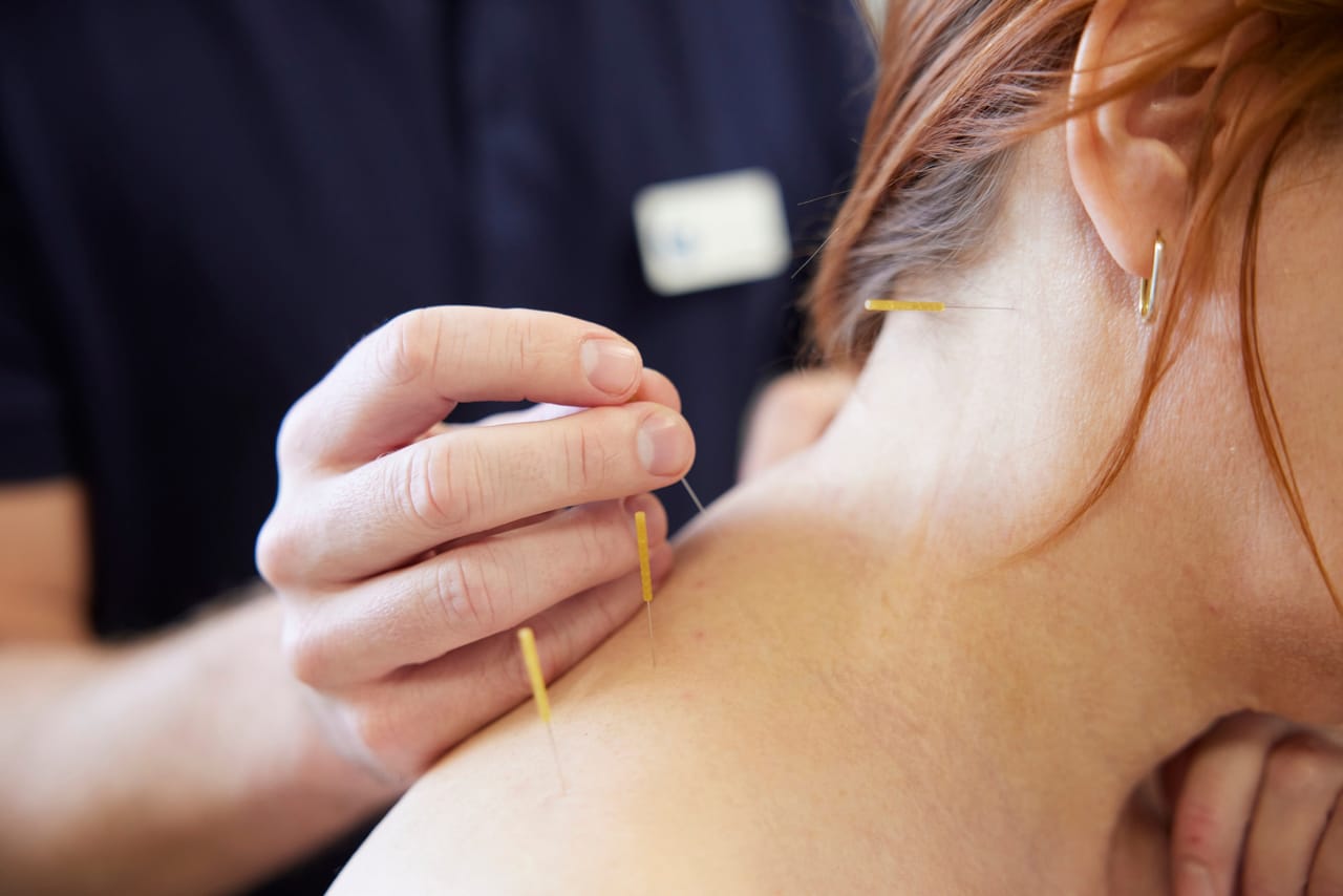 Wie wirkt orthopädische Akupunktur?