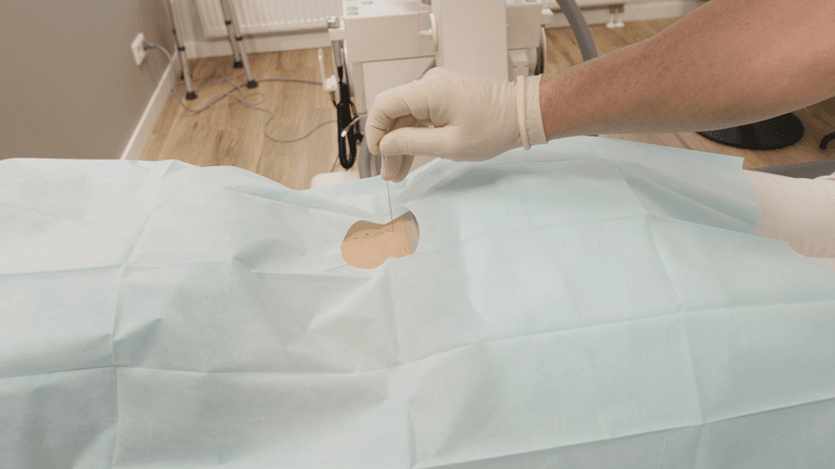 Osteopathie & Dry Needling