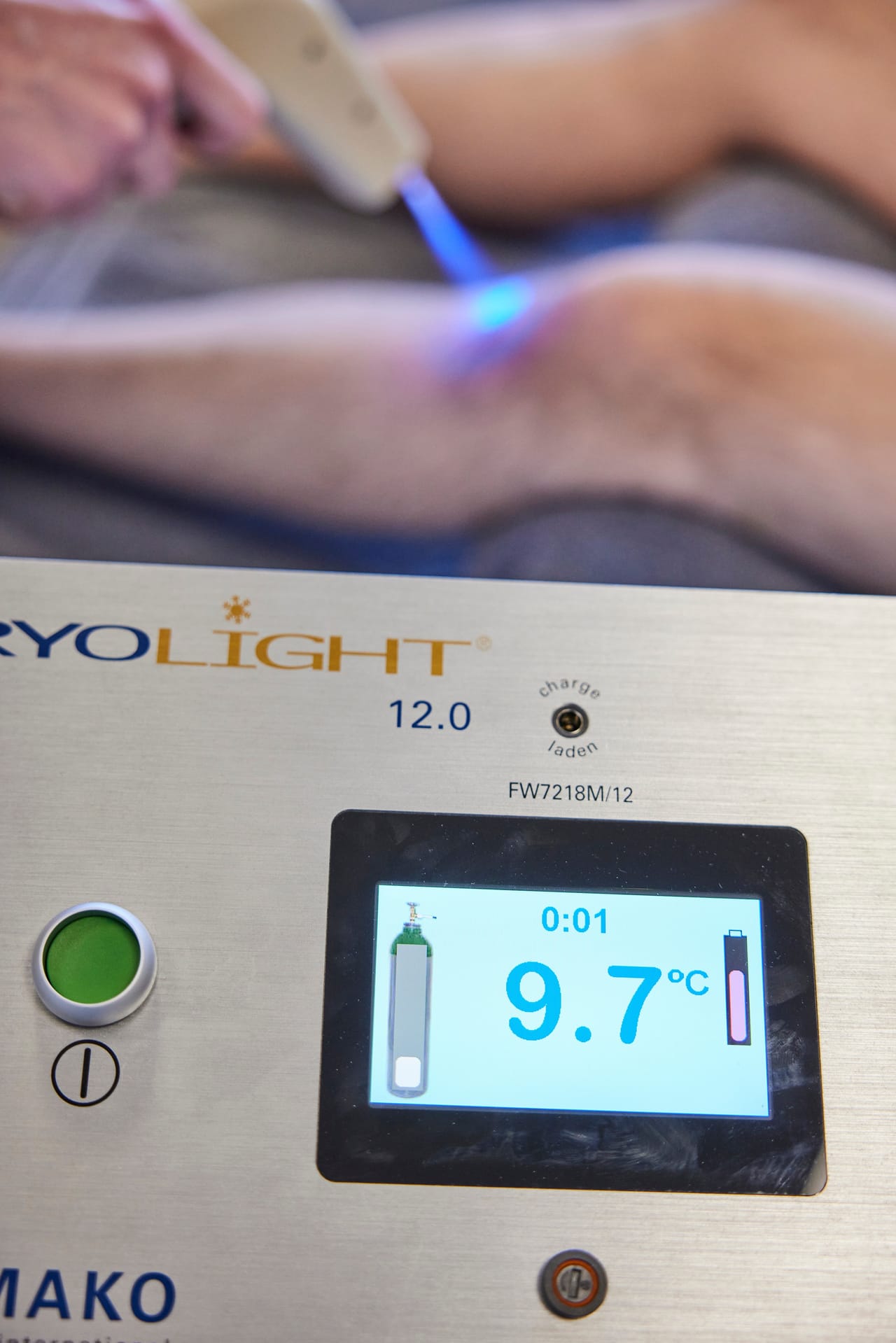 Wie funktioniert lokale Kryotherapie?